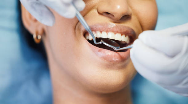 Best Chipped Tooth Repair Near Me  in Auburndale, FL