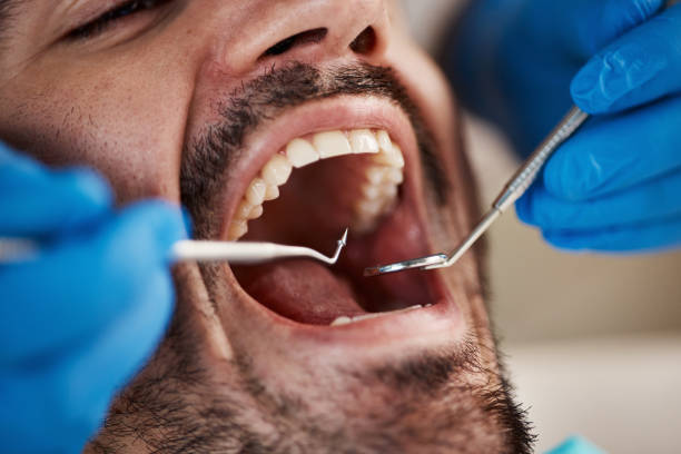 Best Broken Tooth Emergency  in Auburndale, FL